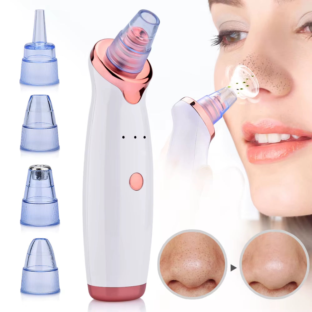 GlowLuxe Blackhead Vacuum Pro
